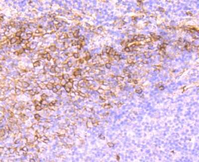Immunohistochemistry-Paraffin: Syndecan-1/CD138 Antibody (JM11-21) [NBP2-67174]