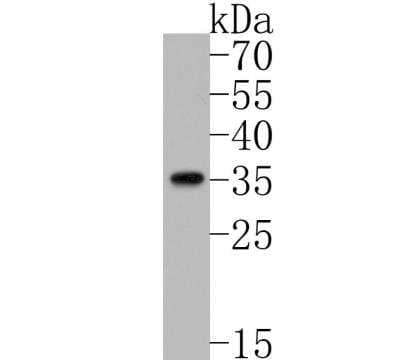 Western Blot: Syndecan-1/CD138 Antibody (JM11-21) [NBP2-67174]