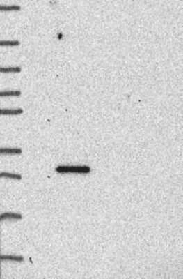 Western Blot: Syndecan-1/CD138 Antibody [NBP3-16984]