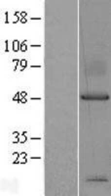 Western Blot: Syndecan-1/CD138 Overexpression Lysate [NBP2-10760]