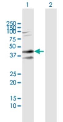 Western Blot: Syndecan-2/CD362 Antibody [H00006383-B04P]