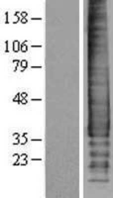 Western Blot: Syndecan-2/CD362 Overexpression Lysate [NBP2-04237]