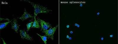 Immunocytochemistry/ Immunofluorescence: Syndecan-4 Antibody (047) [NBP2-90700]