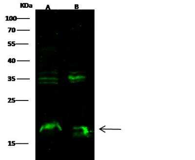 Western Blot: Syndecan-4 Antibody (112) [NBP2-90701]