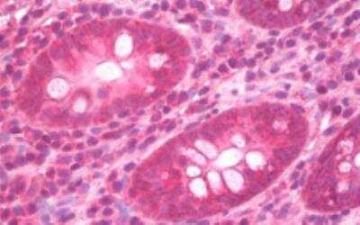 Immunohistochemistry-Paraffin: Syndecan-4 Antibody [NB110-41551]