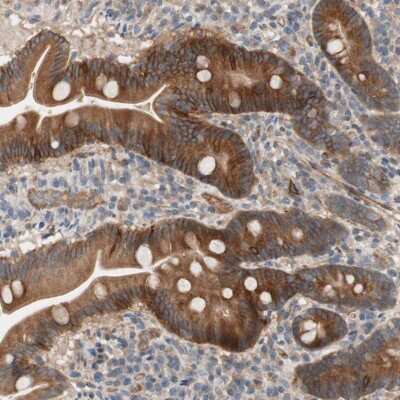 Immunohistochemistry-Paraffin: Syndecan-4 Antibody [NBP1-90173]