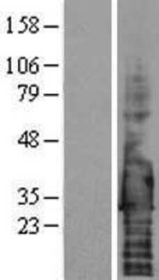 Western Blot: Syndecan-4 Overexpression Lysate [NBP2-04238]