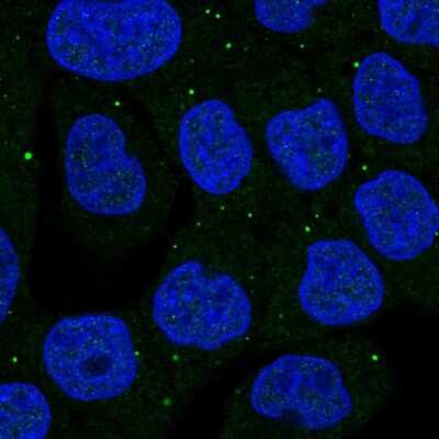 Immunocytochemistry/ Immunofluorescence: Synphilin-1 Antibody [NBP2-55955]