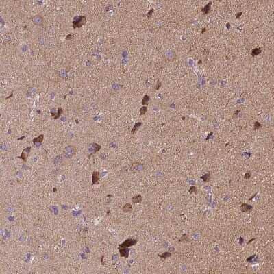 Immunohistochemistry-Paraffin: Synphilin-1 Antibody [NBP2-55955]