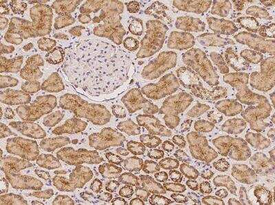 Immunohistochemistry-Paraffin: Synphilin-1 Antibody [NBP3-06159]