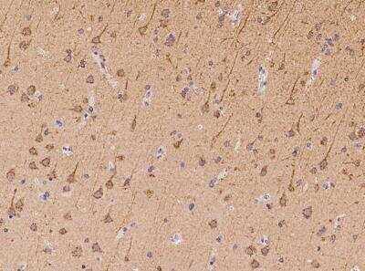 Immunohistochemistry-Paraffin: Synphilin-1 Antibody [NBP3-06159]