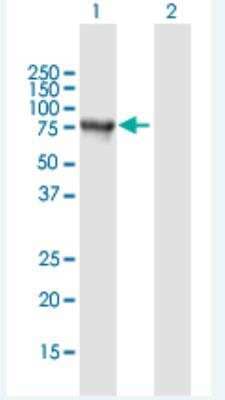 Western Blot: Synphilin-1 Antibody [H00009627-B01P-50ug]