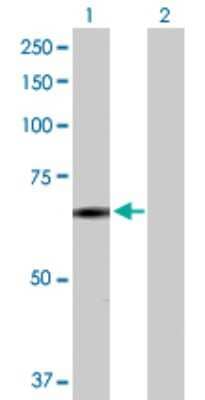 Western Blot: Synphilin-1 Antibody [H00009627-D01P]