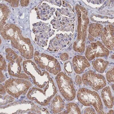 Immunohistochemistry-Paraffin: Syntaphilin Antibody [NBP2-13358]