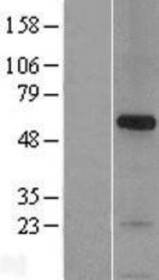 Western Blot: Syntaphilin Overexpression Lysate [NBL1-16283]