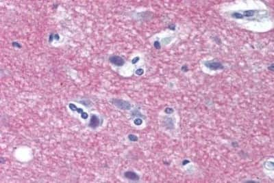 Immunohistochemistry-Paraffin: Syntaxin 1A Antibody [NBP3-14491]