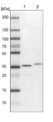 Western Blot: Syntaxin 12 Antibody [NBP1-86985]