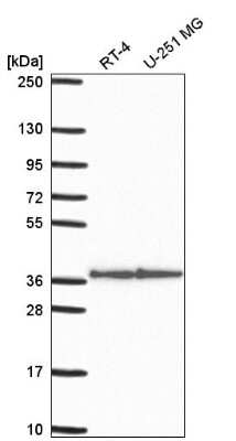 Western Blot: Syntaxin 12 Antibody [NBP2-58568]