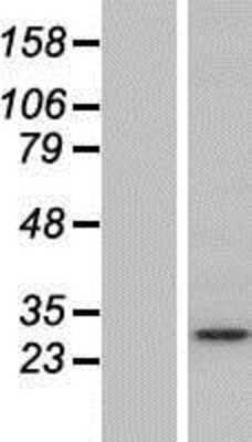 Western Blot: Syntaxin 12 Overexpression Lysate [NBP2-05037]