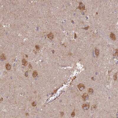 Immunohistochemistry-Paraffin: Syntaxin 16 Antibody [NBP1-92468]