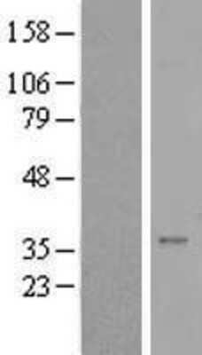 Western Blot: Syntaxin 16 Overexpression Lysate [NBL1-16575]