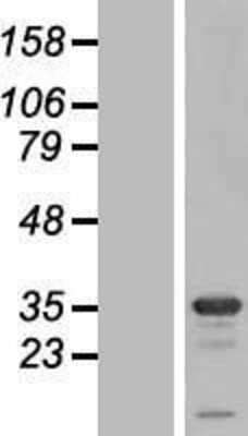 Western Blot: Syntaxin 1B Overexpression Lysate [NBL1-16579]