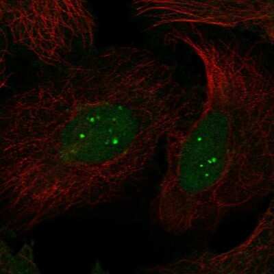 Immunocytochemistry/ Immunofluorescence: Syntaxin 3 Antibody [NBP1-86984]