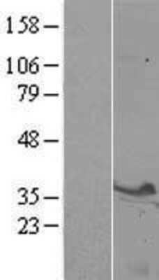 Western Blot: Syntaxin 3 Overexpression Lysate [NBL1-16581]