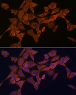 Immunocytochemistry/ Immunofluorescence: Syntaxin 4 Antibody (8F3P7) [NBP3-16629]