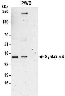 Immunoprecipitation: Syntaxin 4 Antibody [NBP2-32227]