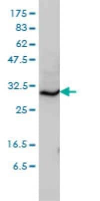 Western Blot: Syntaxin 6 Antibody (1G2) [H00010228-M01]