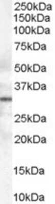 Western Blot: Syntaxin 6 Antibody [NB100-2920]