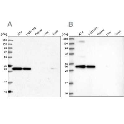 Western Blot: Syntaxin 6 Antibody [NBP1-85869]