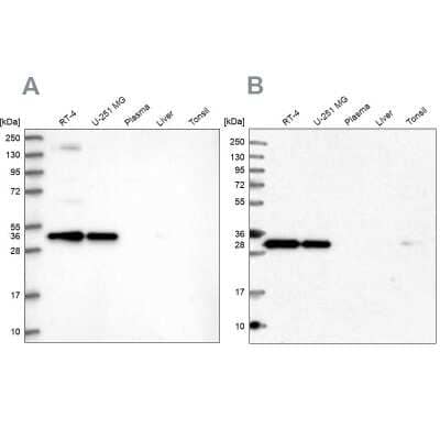 Western Blot: Syntaxin 6 Antibody [NBP2-38417]