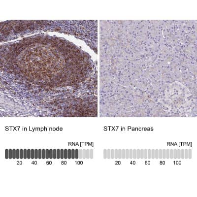 Immunohistochemistry-Paraffin: Syntaxin 7 Antibody [NBP1-87497]