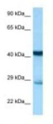 Western Blot: Syntaxin 7 Antibody [NBP1-98376]