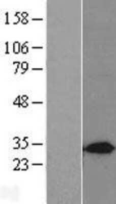 Western Blot: Syntaxin 7 Overexpression Lysate [NBL1-16585]