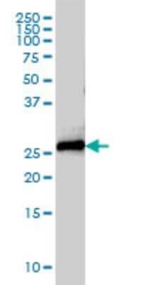 Western Blot: Syntaxin 8 Antibody (2H1-1D11) [H00009482-M01]