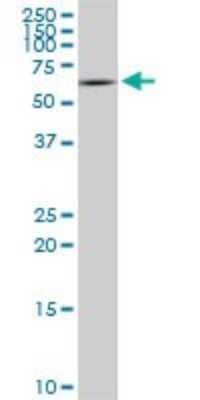 Western Blot: Syntaxin-BP1 Antibody (6D1) [H00006812-M01]