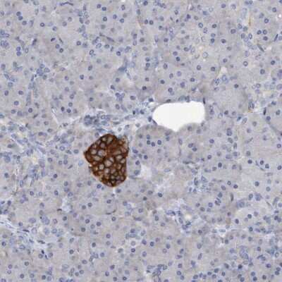 Immunohistochemistry-Paraffin: Syntaxin-BP1 Antibody [NBP1-83138]
