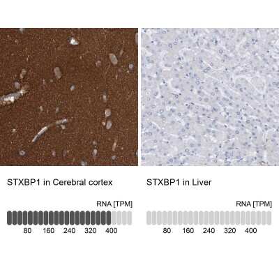 Immunohistochemistry-Paraffin: Syntaxin-BP1 Antibody [NBP1-83138]