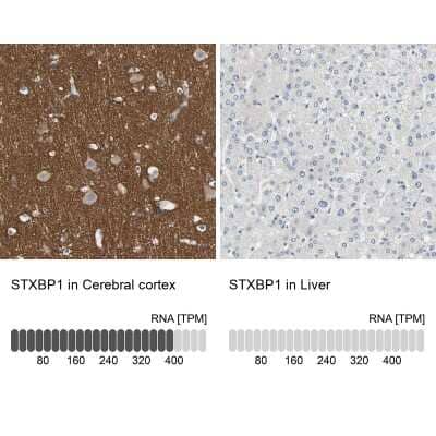 Immunohistochemistry-Paraffin: Syntaxin-BP1 Antibody [NBP1-83139]