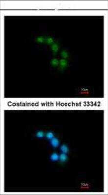 Immunocytochemistry/ Immunofluorescence: Syntaxin-BP2 Antibody [NBP1-33306]