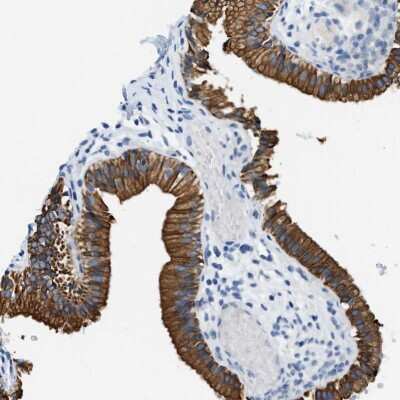 Immunohistochemistry-Paraffin: Syntaxin-BP2 Antibody [NBP1-83137]