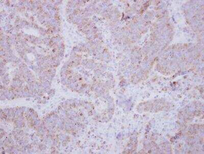 Immunohistochemistry-Paraffin: Syntaxin-BP2 Antibody [NBP2-20527]