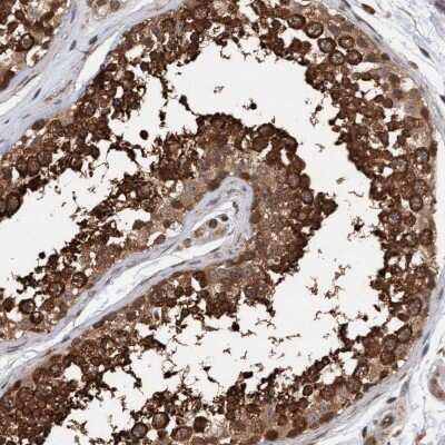 Immunohistochemistry-Paraffin: Syntaxin Binding Protein 4 Antibody [NBP1-92469]