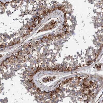 Immunohistochemistry-Paraffin: Syntaxin Binding Protein 4 Antibody [NBP1-92470]