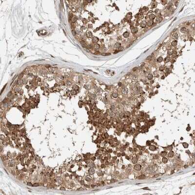 Immunohistochemistry-Paraffin: Syntaxin Binding Protein 4 Antibody [NBP1-92471]