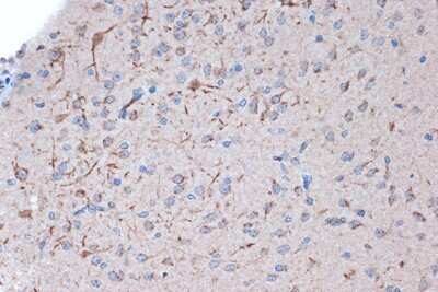 Immunohistochemistry-Paraffin: Syntenin 1 Antibody (3J5O6) [NBP3-16603]