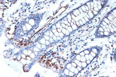 Immunohistochemistry-Paraffin: Syntenin 1 Antibody (3J5O6) [NBP3-16603]